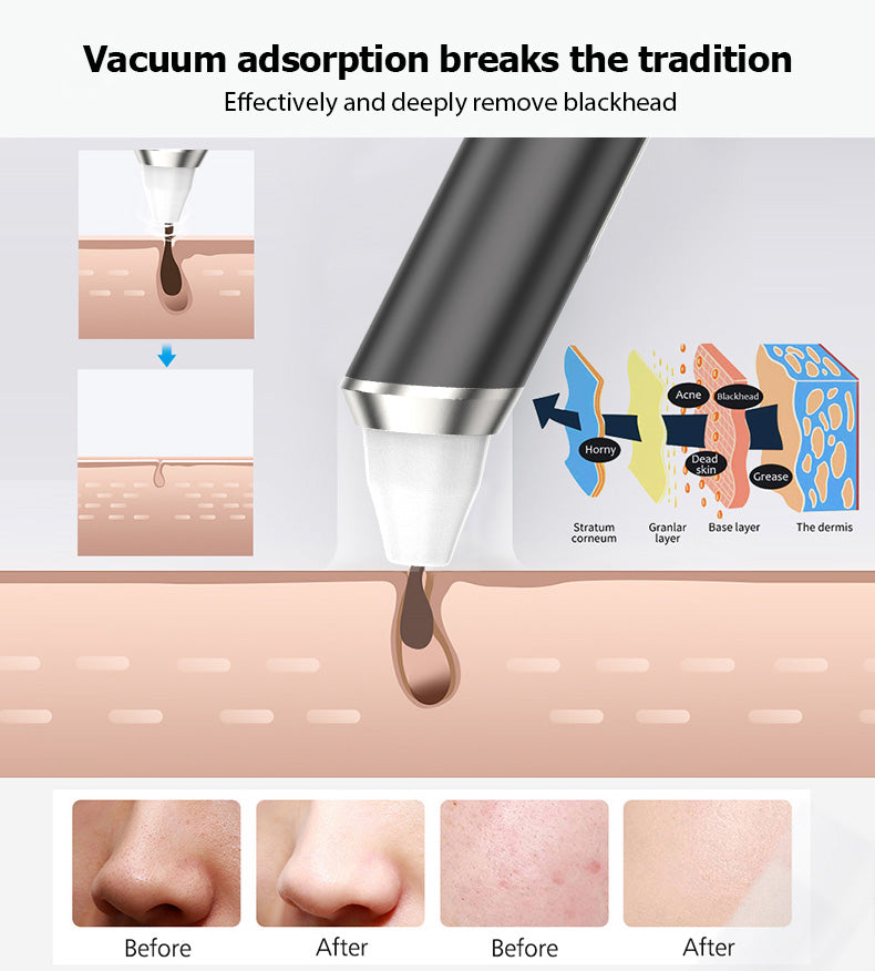 High quality WIFI Visible 2 Replacehead Suction Blackhead Remover With Camera