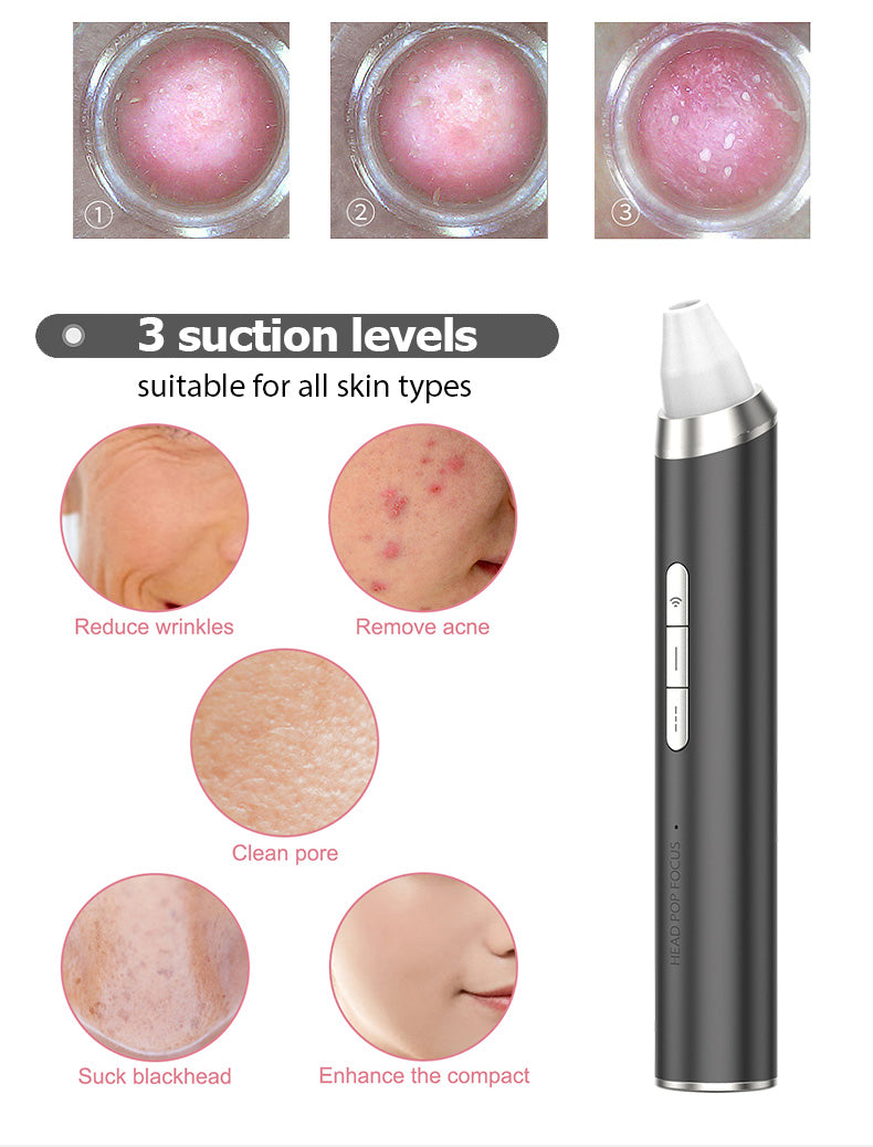 High quality WIFI Visible 2 Replacehead Suction Blackhead Remover With Camera