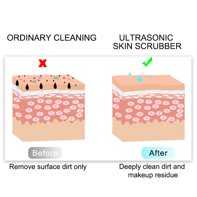 Spatula Ultrasonic LED Facial Skin Scrubber