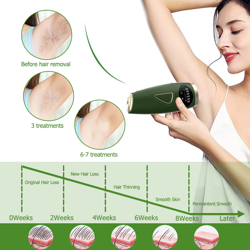 IPL Hair Removal for Women at-Home,Upgraded to 999,000 Flashes