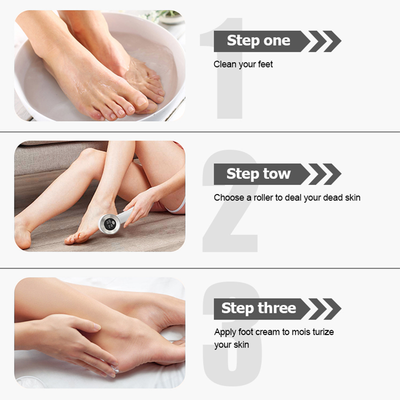 Electric Callus Remover for Feet